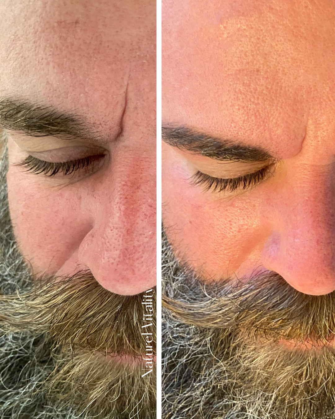 before and after man