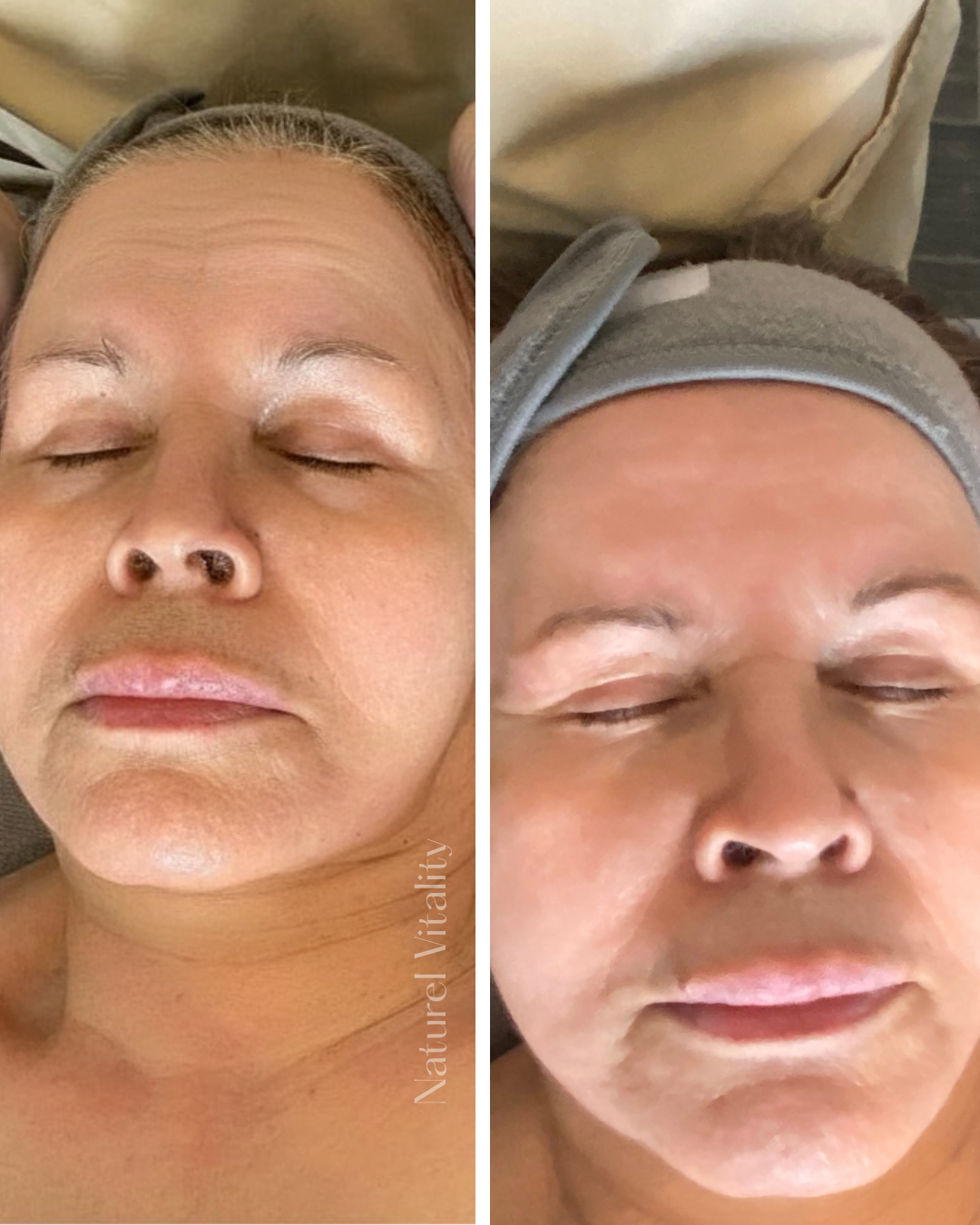before and after mature woman 1