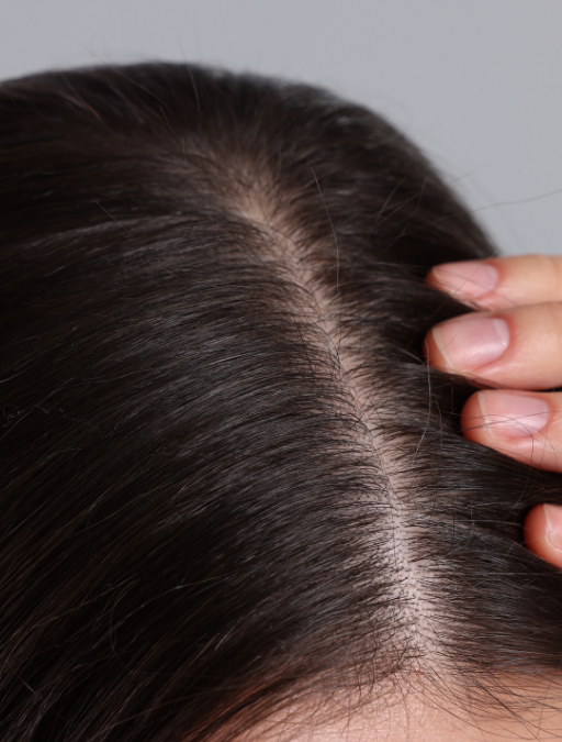 Understanding Hair Loss: Brain Injury and Stress Impact